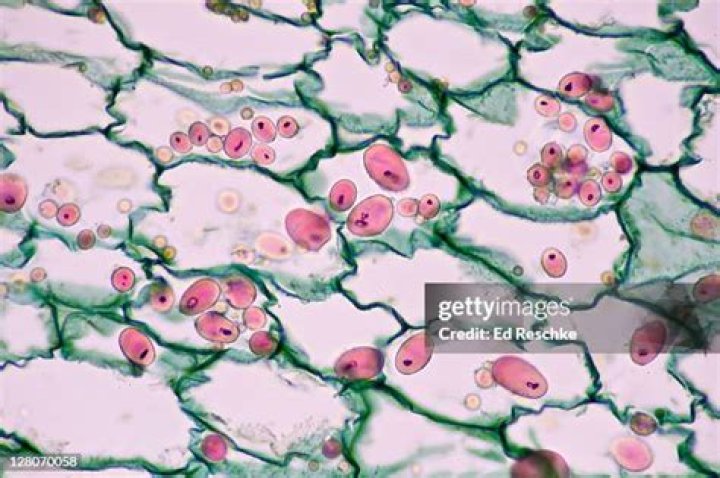 In potato starch is stored in parenchyma?
