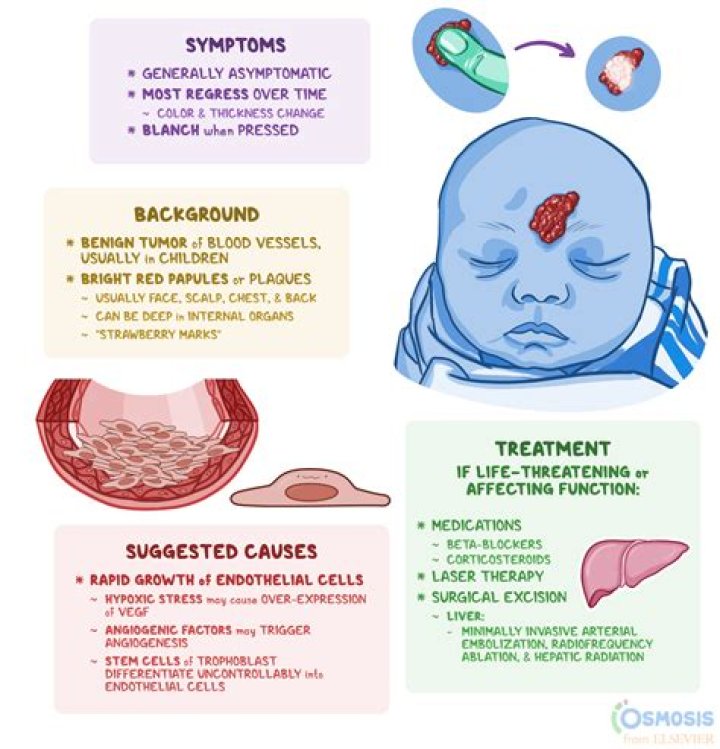 Is a deep hemangioma?