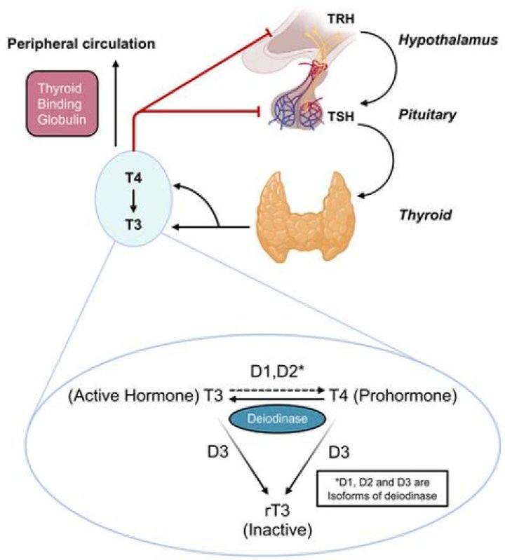 Is an underproduction of thyroid hormone?