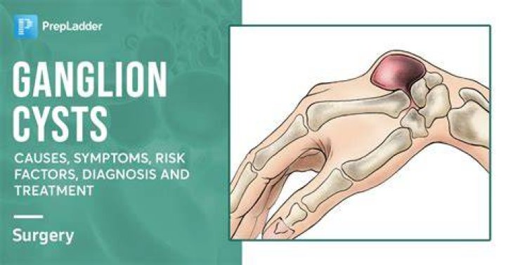 Is ganglion cyst cancerous?
