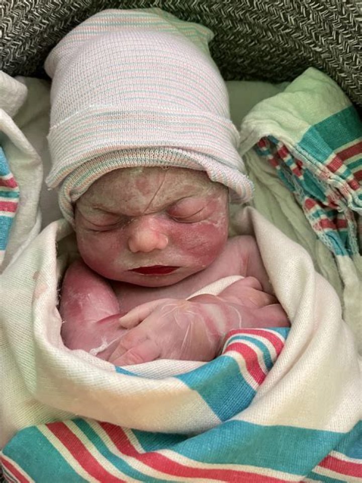 Is it common to have a stillborn baby?