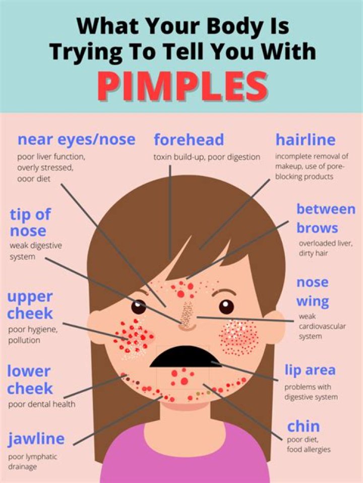 Is it good to pop pimples?