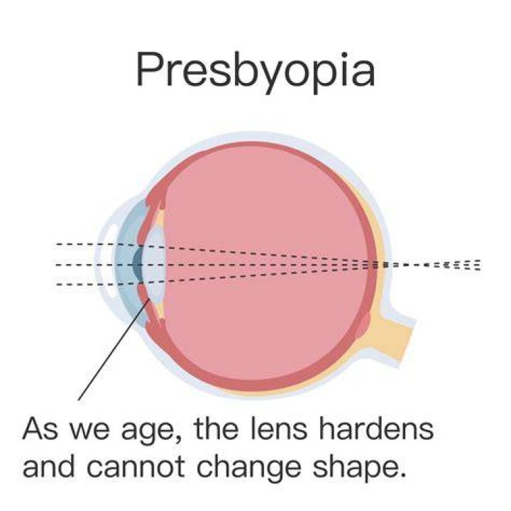 Is presbyopic a word?