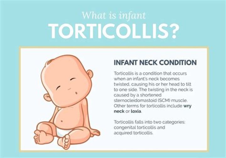 Should you massage torticollis?