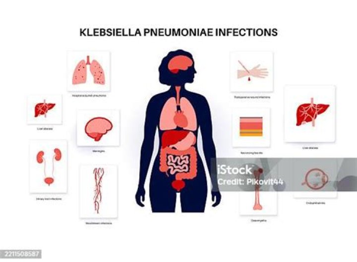 Was ist klebsiella pneumoniae?