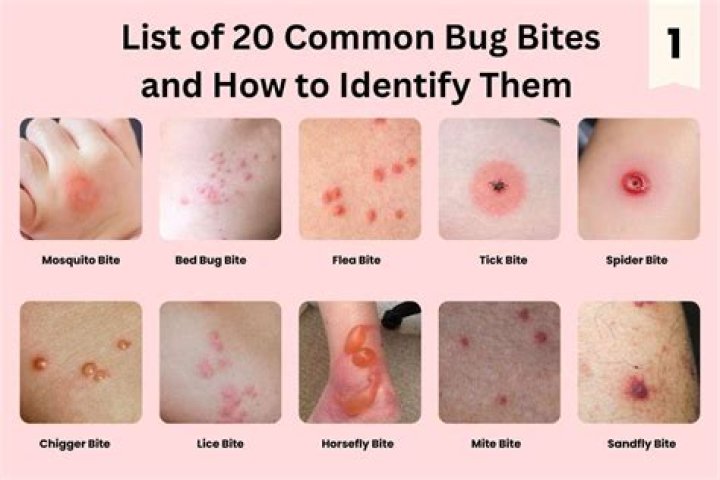 What bugs bite twice?