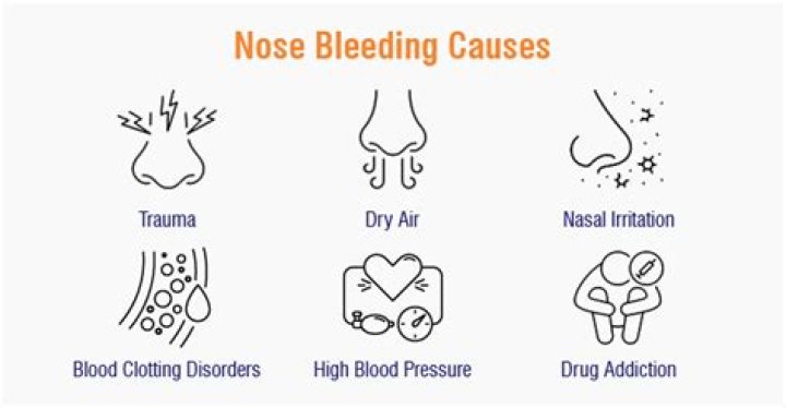 What causes a gushing bloody nose?