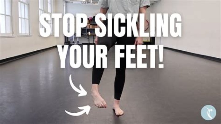 What does a sickled foot mean?
