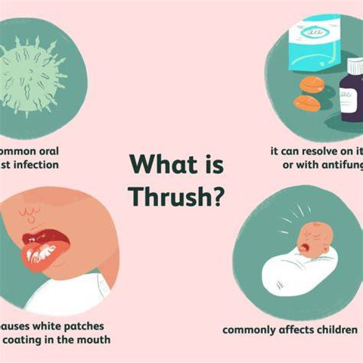 What does having thrush mean?
