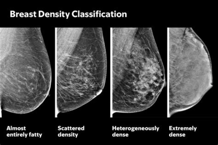 What does heterogeneously dense mean?