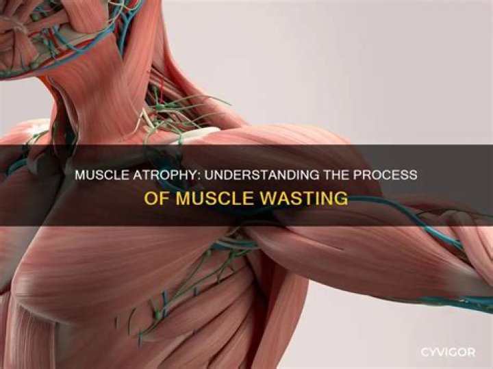 What does muscle wasting feel like?