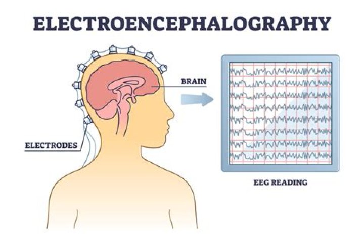 What does the word electroencephalographically mean?