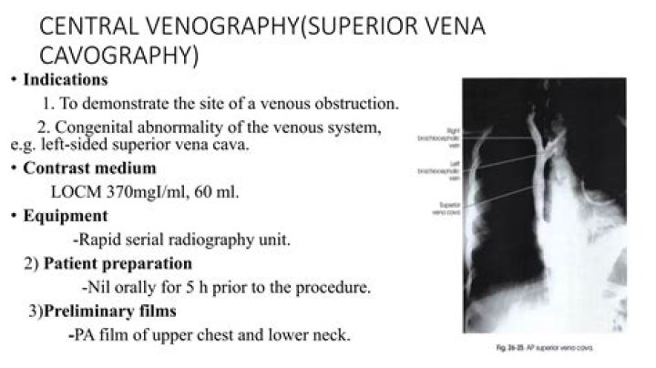 What does venogram mean in medical terms?