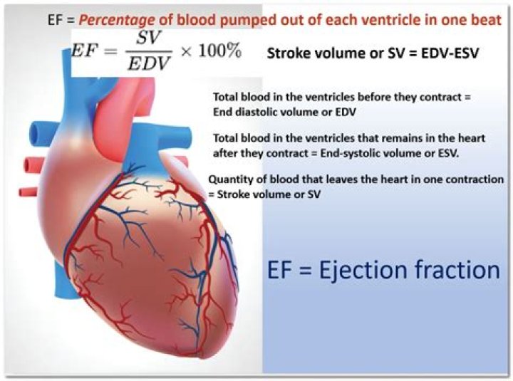 What ejection fraction is considered severe?