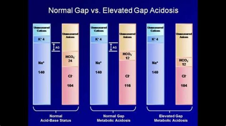 What is a anion gap?