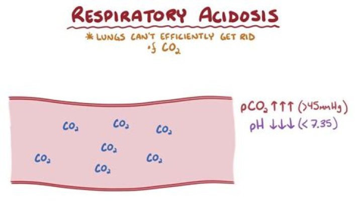 What is hypercapnic acidosis?