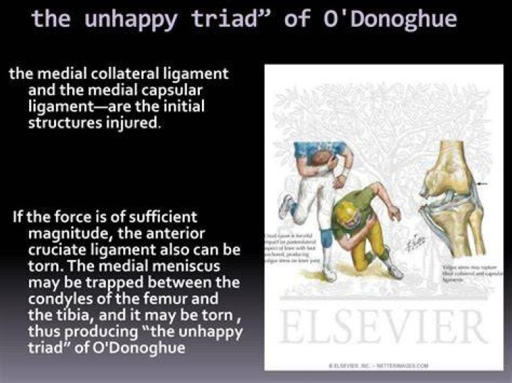 What is o donoghue triad?
