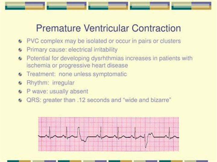 What is premature ventricular contractions?
