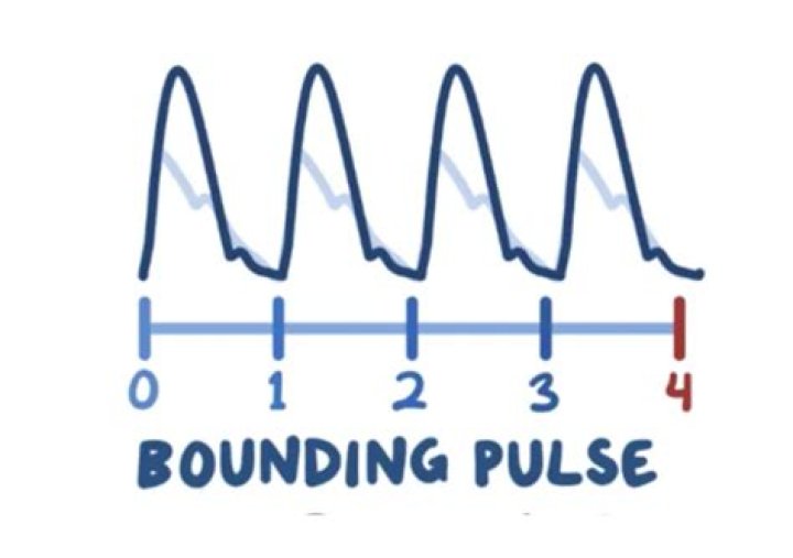 Whats a bounding pulse?