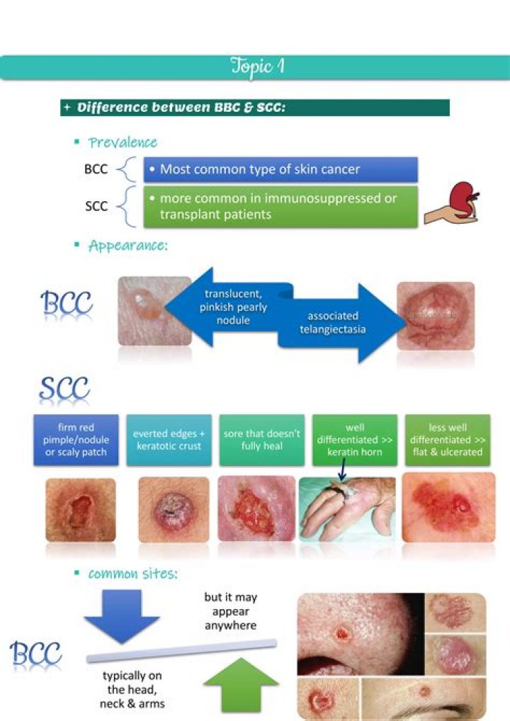 Whats worse bcc or scc?