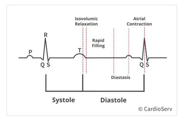 When does diastole occur?