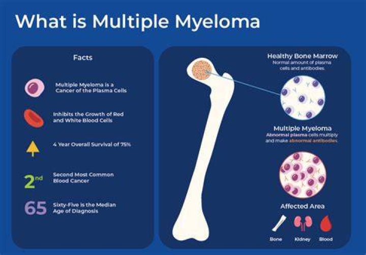 When does myeloma become terminal?
