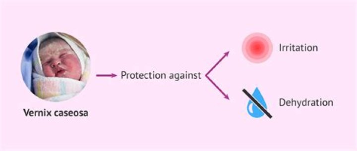 When does vernix caseosa develop?