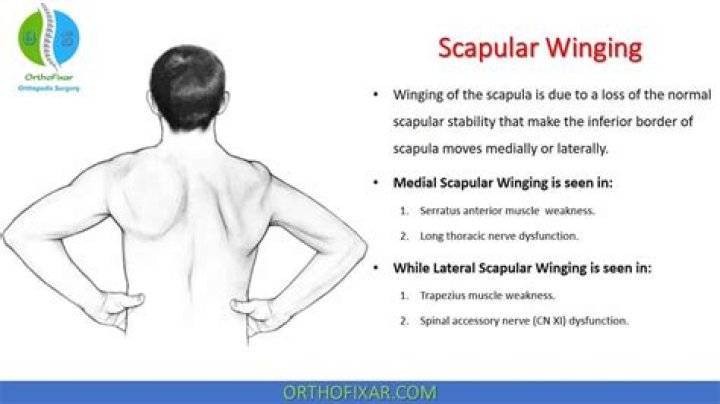 When does winging of the scapula happen?