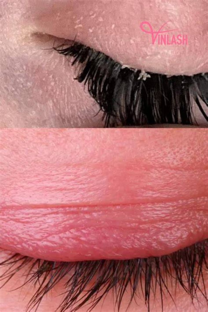 When eyelash extensions itch?