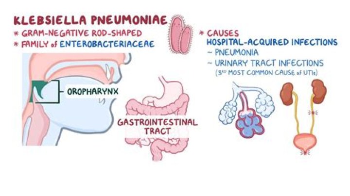 Where does klebsiella pneumoniae come from?