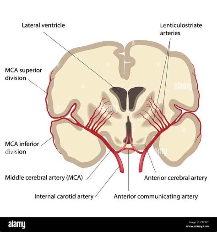 Where is the middle cerebral artery?