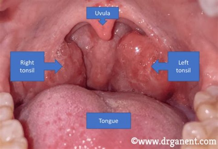 Where is your uvula?