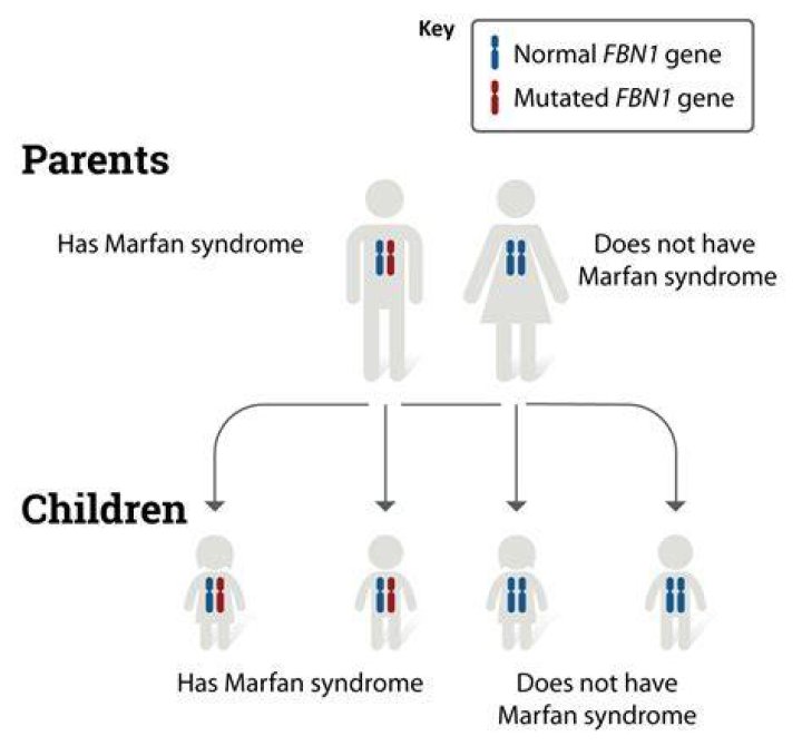 Which chromosome is marfan syndrome located on?