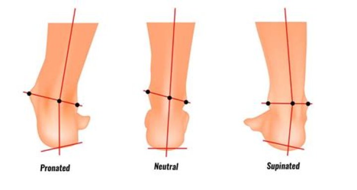 Which muscles supinate the foot?