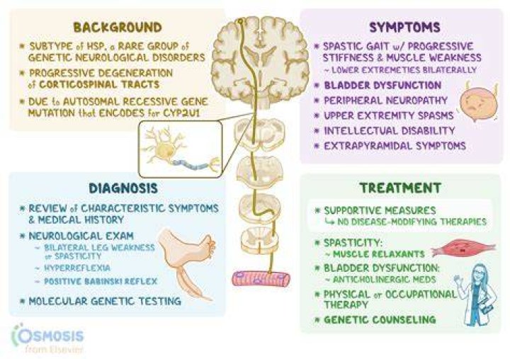 Which of the following causes spastic paralysis?