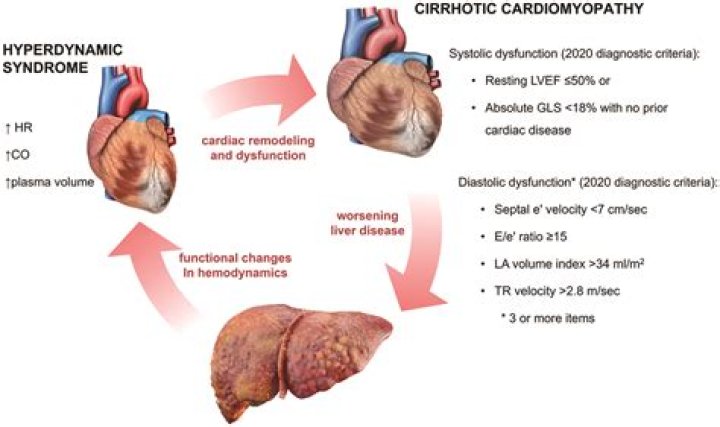 Which system does cirrhosis affect?