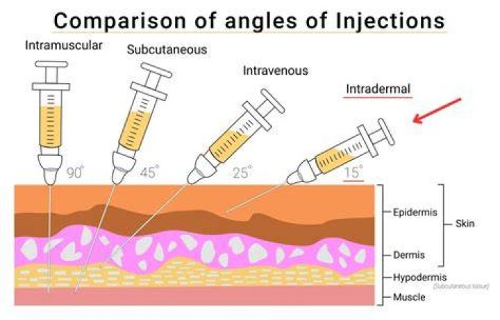 Which vaccines are given intradermally?