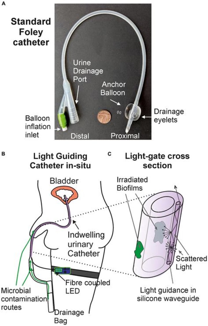 Who are indwelling catheter?