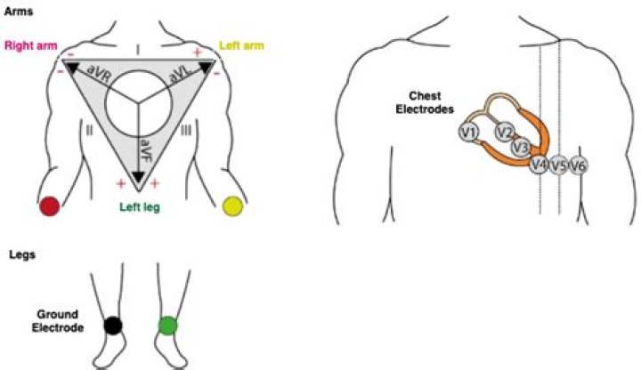Why are inactive electrodes used?