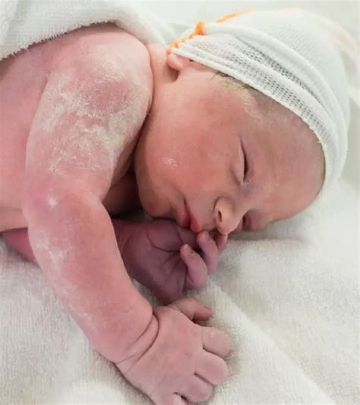 Why are some babies born with vernix?