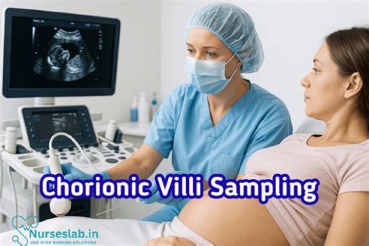 Why chorionic villus sampling?