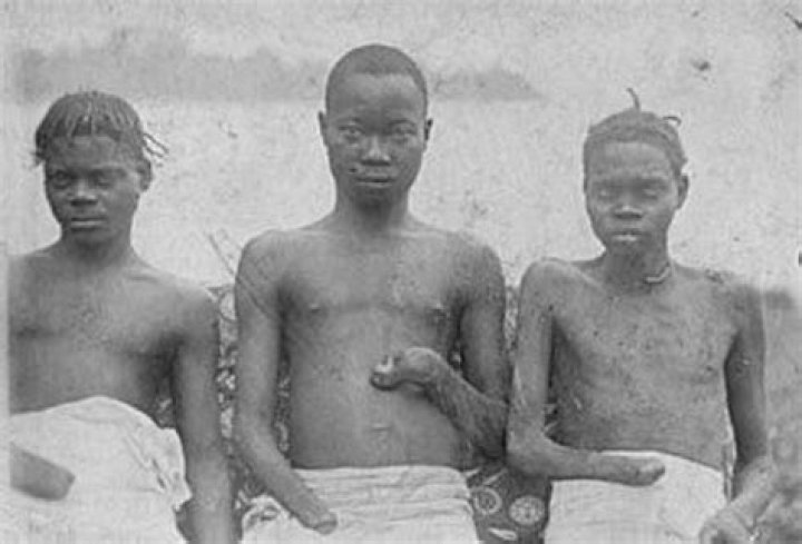 Why did leopold cut off hands?