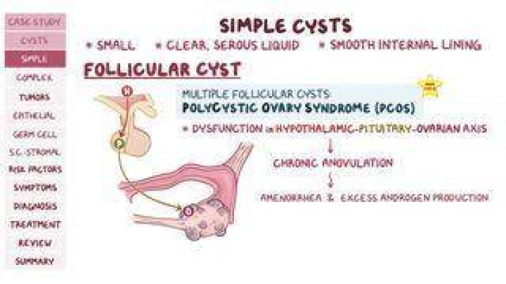 Why do follicular cysts form?