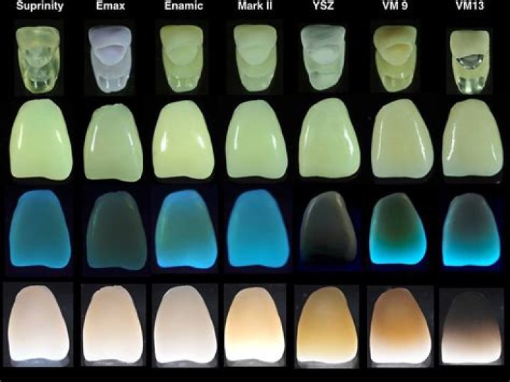 Why do teeth glow in blacklight?