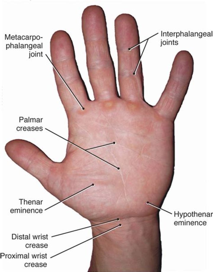 Why does my hypothenar hurt?