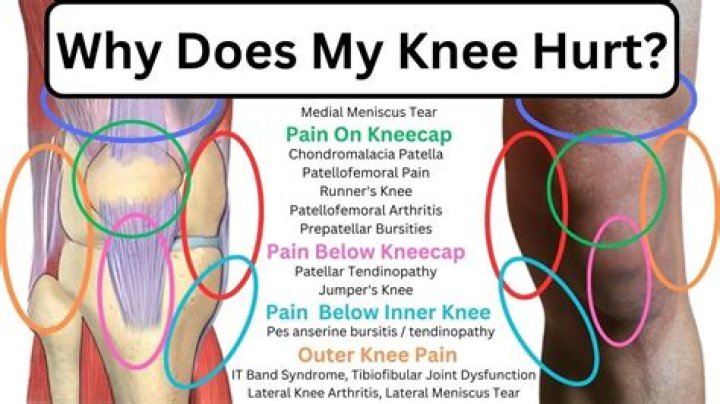 Why does my knee hurt when i unbend it?