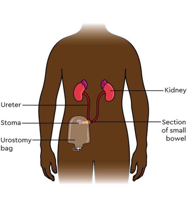 Why stomach empties slowly?