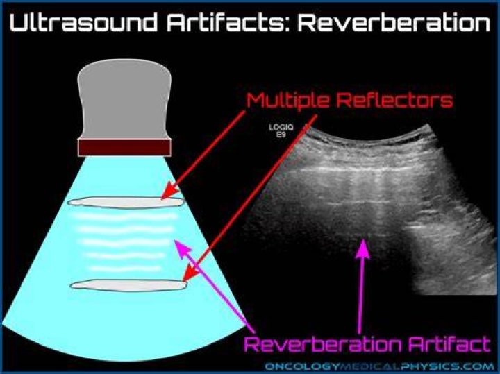 Why would reverberation be a problem?