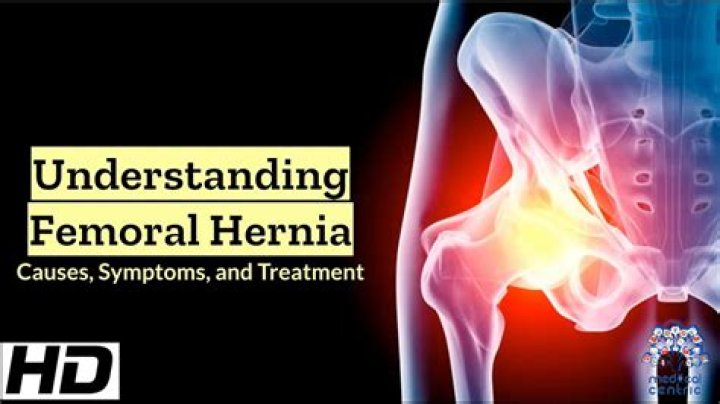 Will a femoral hernia heal itself?