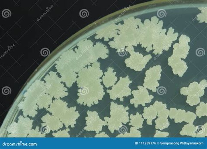 Will bacillus subtilis grow on tsa?